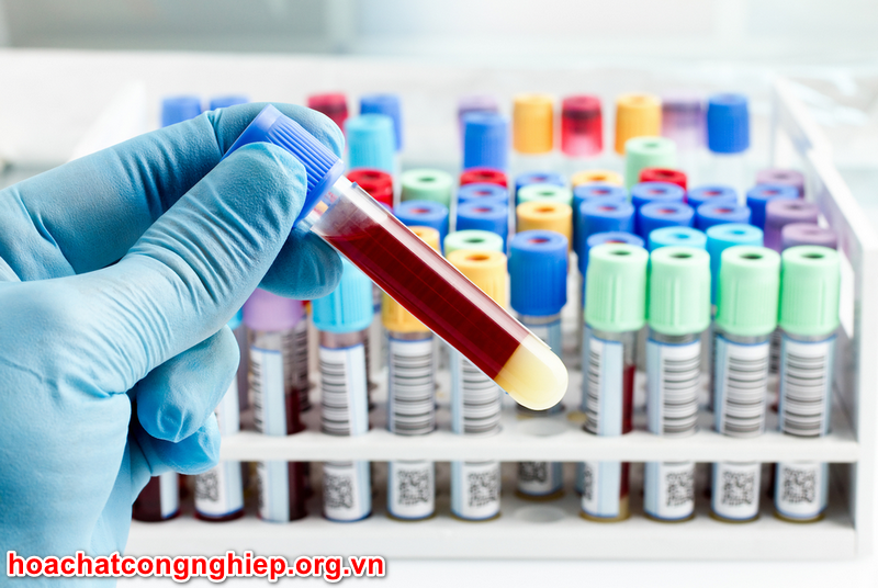 Vai trò của Hóa Chất trong lĩnh vực y học là xét nghiệm máu